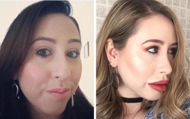 25 чудиков, которые решили увеличить губы, но что-то пошло не так 25 чудиков, которые решили увеличить губы, но что-то пошло не так