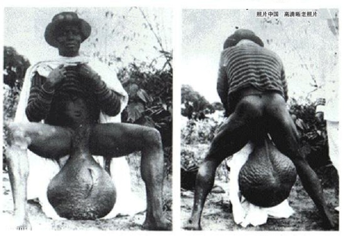 Африканские аномалии: племя бубал с гигантскими гениталиями Африка,шок, аномалии, обычаи, отклонения