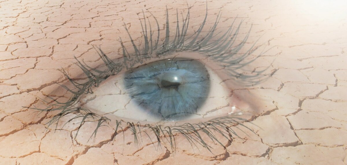 Почему возникает сухость глаз ? Причины, симптомы, лечение и профилактика.
