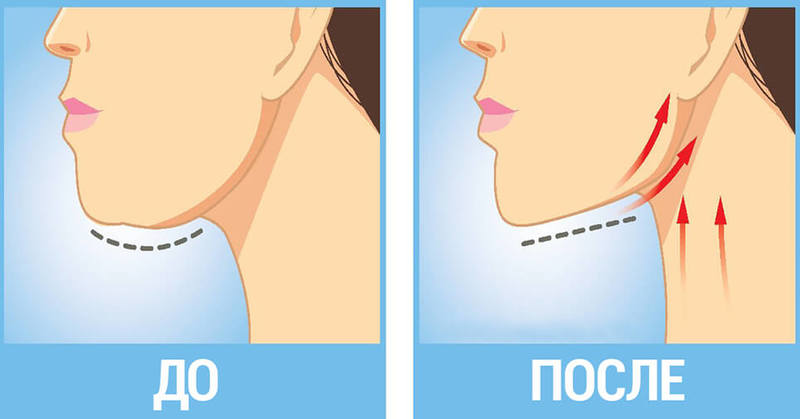 Избавляемся от двойного подбородка: экспресс-метод Мамада Йошико здоровье,красота,лицо,молодость,мышцы,упражнения
