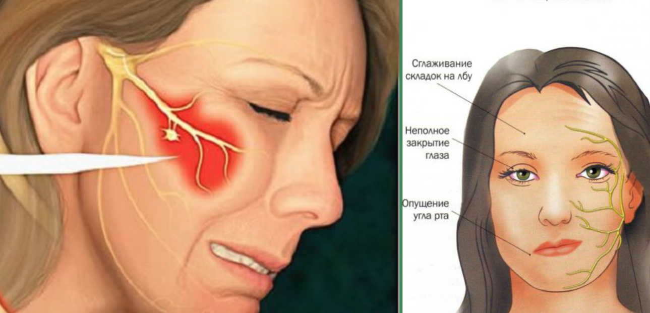 Нервная система после 40 лет нуждается в поддержке