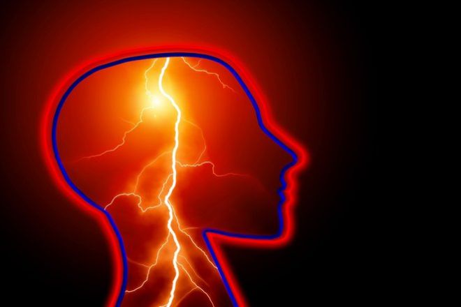 25 неожиданных фактов об эпилепсии