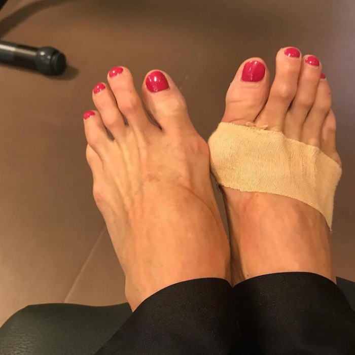 «Мои мозоли прекраснее вашего лица»: Волочкова жестко ответила подписчикам «Мои мозоли прекраснее вашего лица»: Волочкова жестко ответила подписчикам