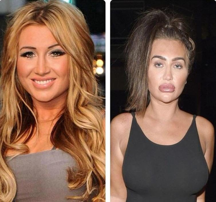 25 чудиков, которые решили увеличить губы, но что-то пошло не так 25 чудиков, которые решили увеличить губы, но что-то пошло не так