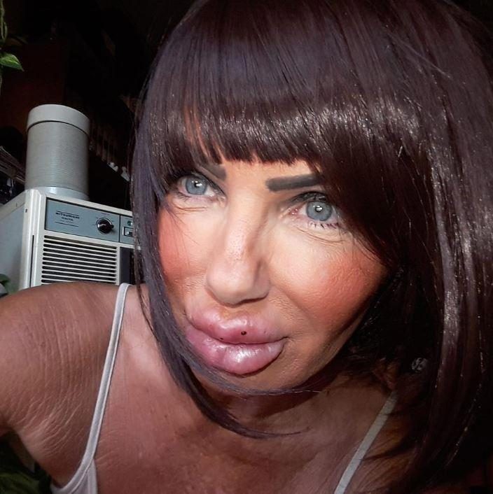 25 чудиков, которые решили увеличить губы, но что-то пошло не так 25 чудиков, которые решили увеличить губы, но что-то пошло не так