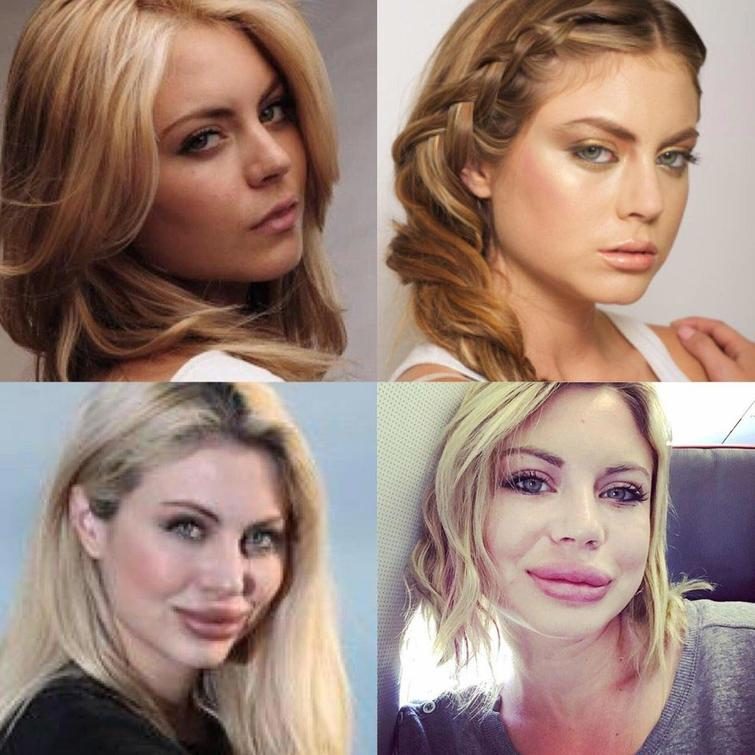 25 чудиков, которые решили увеличить губы, но что-то пошло не так 25 чудиков, которые решили увеличить губы, но что-то пошло не так