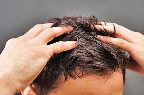Причины появления болячек на голове и способы их лечения. Виды себорейного дерматита