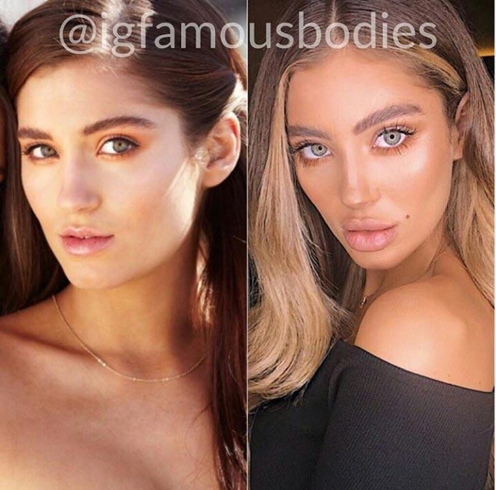 25 чудиков, которые решили увеличить губы, но что-то пошло не так 25 чудиков, которые решили увеличить губы, но что-то пошло не так