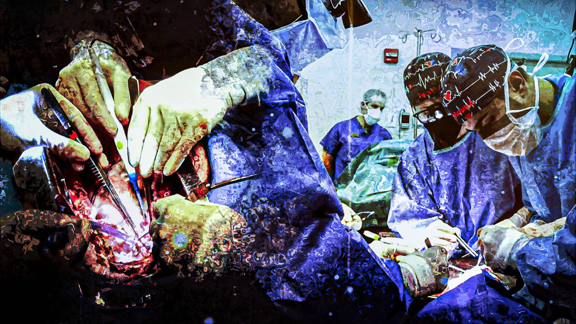 Американские ученые провели успешную операцию по пересадке сердца свиньи человеку