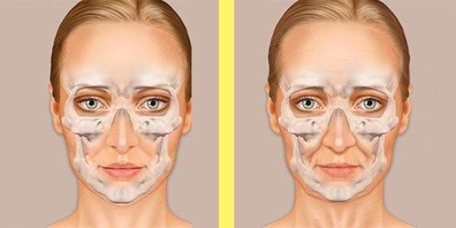 возрастные изменения лица. изменение лица с возрастом. лицо в 20 30 40. горизонтальные морщины. лицо в 20 30 40.