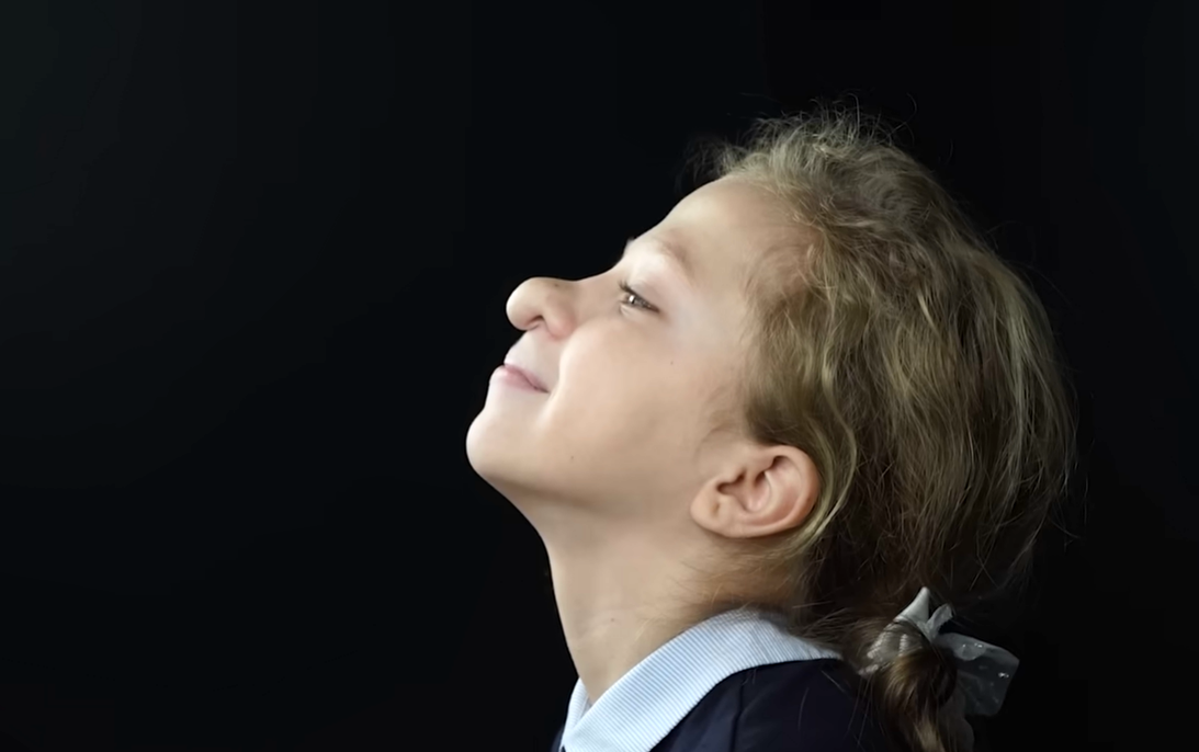 Как сейчас выглядит девочка Варя из Калужской области, которой в 10 лет прооперировали нос девочки, детей, после, делать, блогер, операции, только, Сергей, результат, когда, родилась, Лукьянов, девочка, занимается, операцию, быстро, длительного, очень, стало, мамой