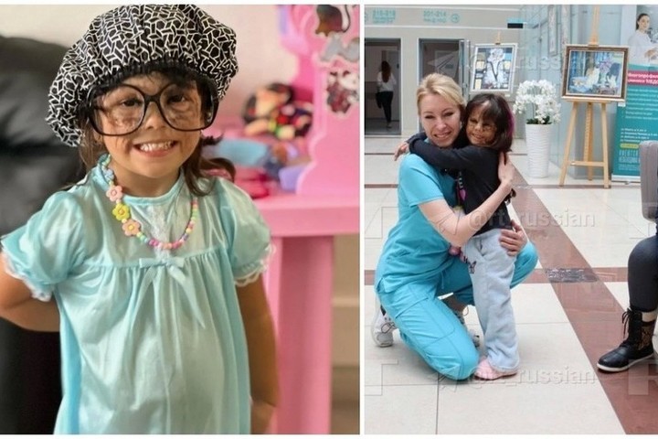 Российские врачи провели успешную операцию американской девочке «с маской Бэтмена»