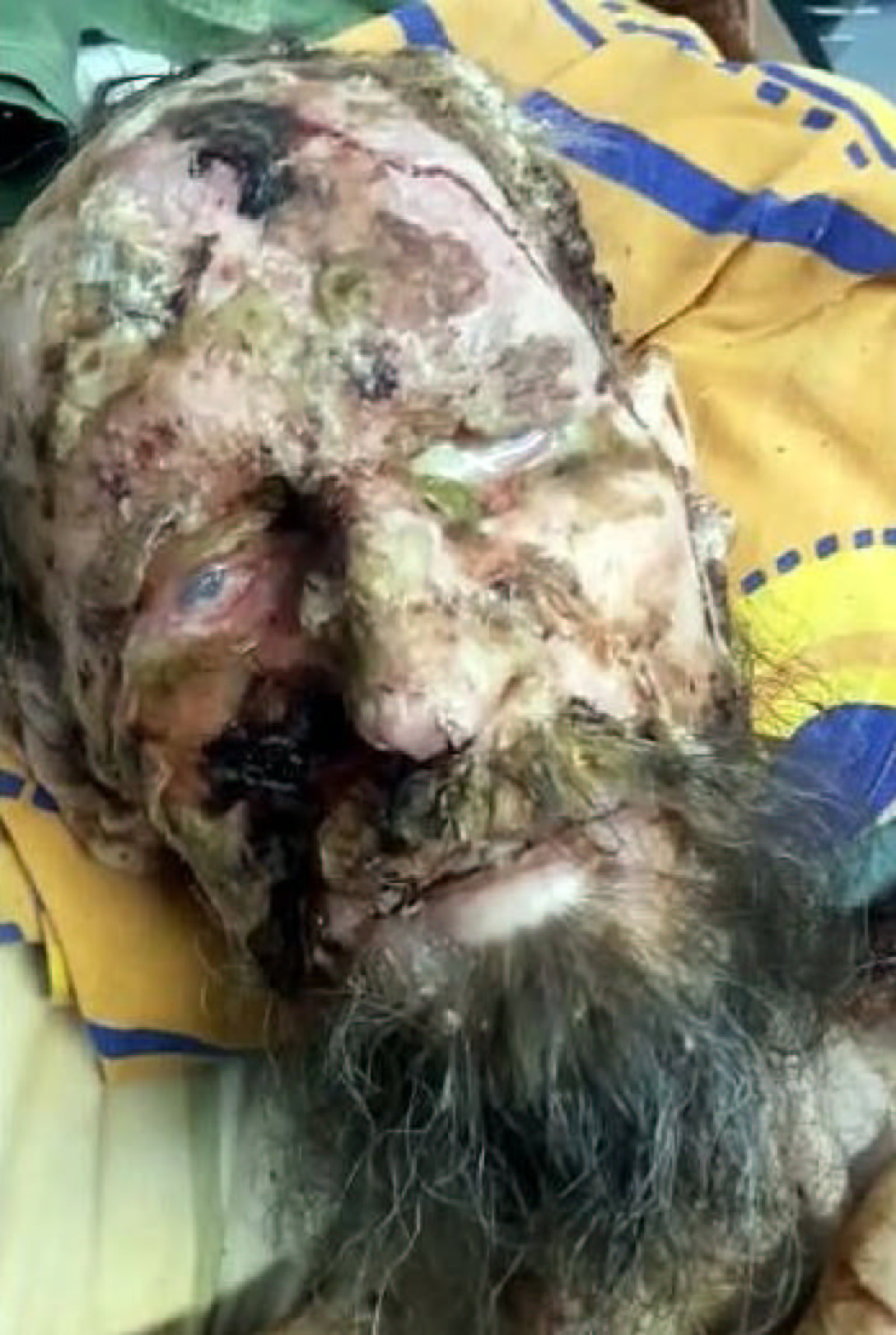 Не пожелавшие сдаться смерти Не пожелавшие сдаться смерти доказательства,загадки,история,мистика,аномалии,спорные вопросы