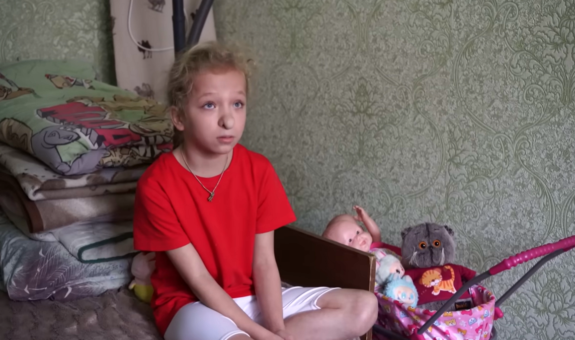 Как сейчас выглядит девочка Варя из Калужской области, которой в 10 лет прооперировали нос девочки, детей, после, делать, блогер, операции, только, Сергей, результат, когда, родилась, Лукьянов, девочка, занимается, операцию, быстро, длительного, очень, стало, мамой