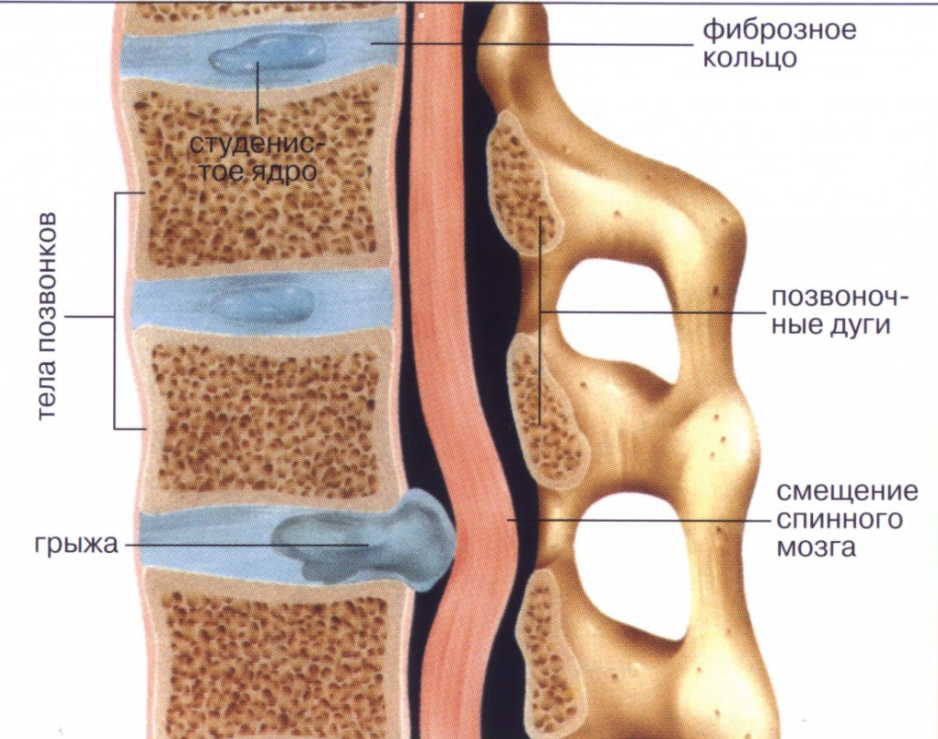 Если ноги стали слабыми - ищите причину в позвоночнике!