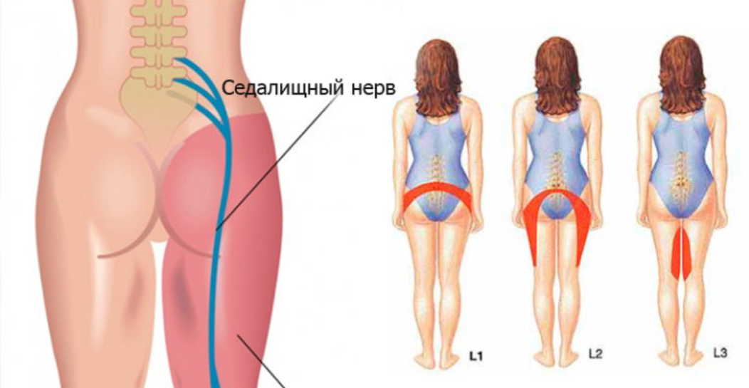 Если ноги стали слабыми - ищите причину в позвоночнике!