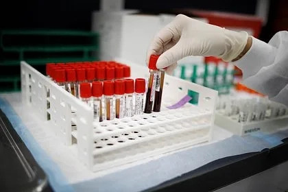Врач предостерегла от снижения уровня холестерина в некоторых случаях