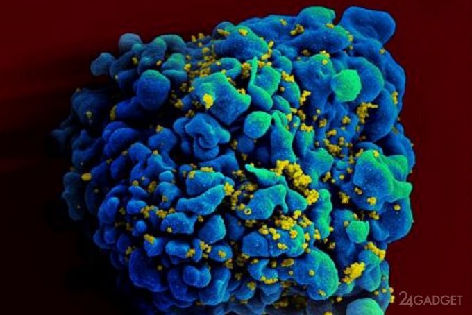 Вакцина от ВИЧ на базе мРНК успешно испытана на животных будущее,ВИЧ,здоровье,наука,технологии,ученые