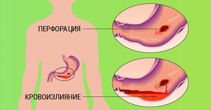 вред курения для желудка