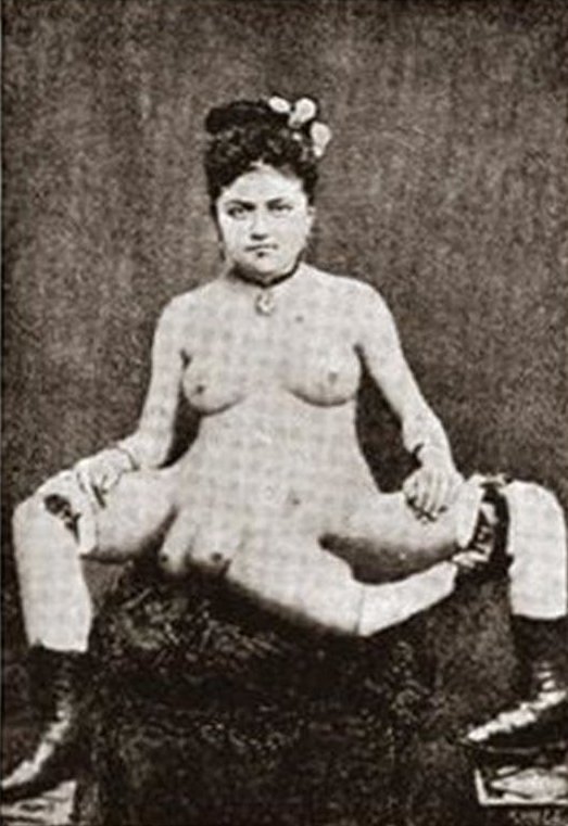 2. Бланш Дюма родилась на Карибском острове Мартиника в 1860 году интересно, история, люди-мутанты, мутации, прошлое, фото