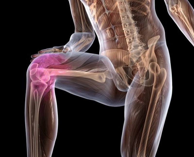 90% болей в коленях связаны не с самим коленом артроз, восстановление,здоровье, мышцы, приседания, растяжка