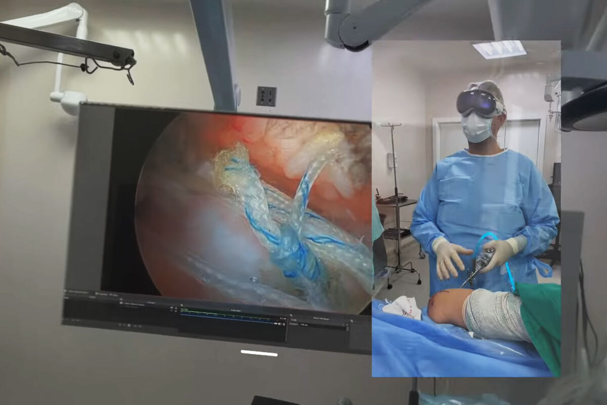 MacMagazine: в Бразилии хирург провел операцию в шлеме Apple Vision Pro