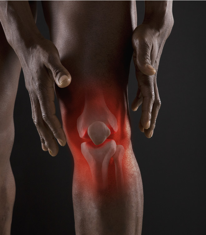 90% болей в коленях связаны не с самим коленом артроз, восстановление,здоровье, мышцы, приседания, растяжка