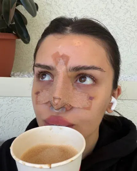 Дина Саева показала себя после операции на носу Саева, СаеваДина, также, Саевой, дышать, сделала, блогерша, конце, операцию, слухи, подтвердили, нормально, после, операцииДина, экстремистской, Никитой, появились, СаеваЛетом, грудиДина, увеличению