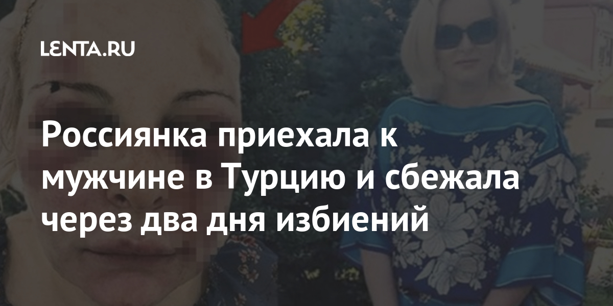 Россиянка приехала к мужчине в Турцию и сбежала через два дня избиений России, нападавший, больницу, марта, отеле, Российские, часов, несколько, продолжались, избиения, следующий, изуродовать, убить, угрожая, турок, подругу, начал, напился, мужчина, вечером