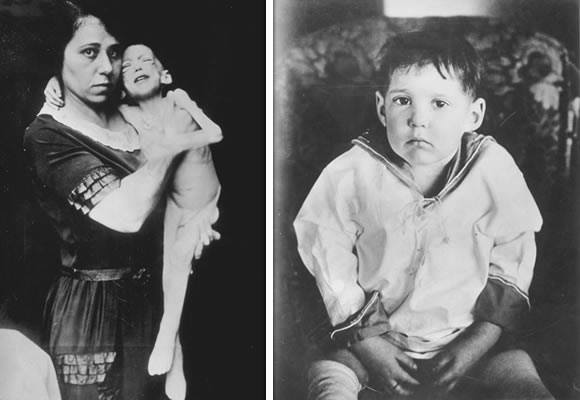 23 января 1922 года была сделана первая инъекция инсулина человеку, которая спасла ему жизнь Бантинг, Паулеску, Маклеод, инсулин, поджелудочной, который, Лангерганса, сахара, премии, крови, железы, Маклеода, лаборатории, Коллип, собак, уровень, Бантинга, снимок, опыта, румынский