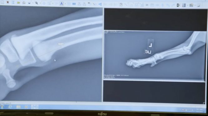 6-ruuxa-raina-x-ray-667x372